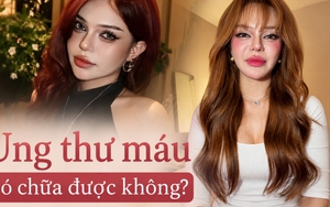 TikToker Đan Thy thông báo mắc ung thư máu ở tuổi 23: Ung thư máu có chữa được không?
