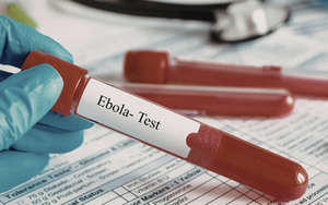 TPHCM tăng cường giám sát cửa khẩu, chủ động phòng nguy cơ dịch bệnh Ebola xâm nhập