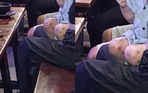 Bé gái xuất hiện tại quán "bar beer" ở Hà Nội với nhiều dấu hiệu bất thường: Kết quả xác minh