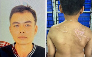 Thi hành Lệnh bắt tạm giam Nguyễn Hà Chung, nạn nhân là con ruột mới hơn 7 tuổi