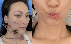 Nữ chính phim trăm tỷ của Trấn Thành: Từng đi bán xôi lề đường, bị biến chứng sau ca mổ tuyến giáp