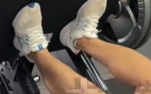 Nam thanh niên 23 tuổi suy thận cấp sau khi tập gym, chỉ số tổn thương cơ tăng gấp 100 lần