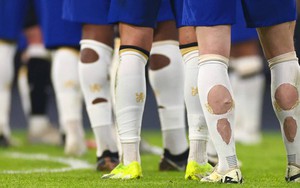 Phát hiện nhiều cầu thủ World Cup đi tất rách ra sân