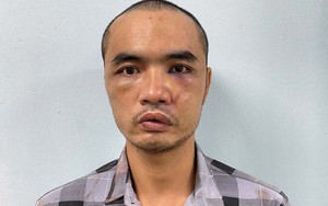 Kẻ dùng dao chém loạt kính ô tô đỗ trên phố Hà Nội khai gì?