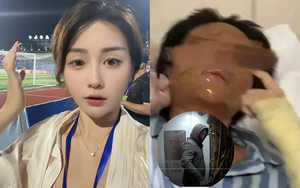 Nữ streamer xinh đẹp bị “hủy dung” sau khi mở gói hàng, danh tính shipper được tiết lộ khiến cô hoảng sợ