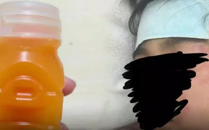 Mua nước cam ép sẵn trên đường, mẹ hốt hoảng khi thấy toàn cơ thể con trai xuất hiện dấu hiệu lạ