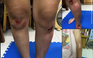 Công an xác minh thông tin vụ 2 cô gái bị đánh sau va chạm giao thông