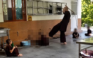 Vụ 5 chú tiểu ở chùa Bầu bị đánh gây thương tích: Bộ Y tế vào cuộc