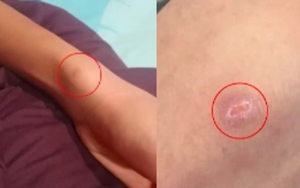 Bố mẹ đi làm xa, khi về nhà thì sốc với các vết thương trên cơ thể con trai, nghe lời kể càng bàng hoàng