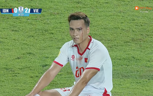 Xót xa khoảnh khắc Bùi Hoàng Việt Anh rách mí mắt, máu chảy ròng ở trận Việt Nam gặp Indonesia