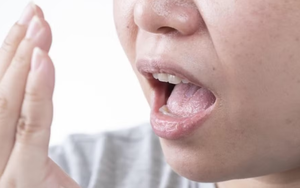 9 dấu hiệu thận đang ‘kêu cứu’
