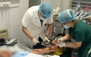 Chó nhà bất ngờ tấn công: Người gãy xương, người lóc da cẳng tay lộ gân cơ