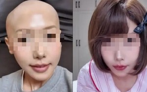Nữ blogger nổi tiếng qua đời ở tuổi 25 vì ung thư dạ dày: Ai cũng giật mình khi biết món "khoái khẩu" của cô ấy...
