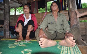 Nghe lời thầy bói, vợ chồng mắc bệnh viêm da lạ bỏ viện