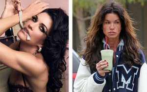 Kết cục tàn nhẫn của mỹ nhân dao kéo