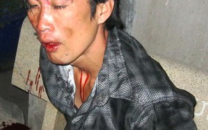TP.HCM: “Hiệp sĩ đường phố” bắt gọn tên cướp sau 10km truy đuổi