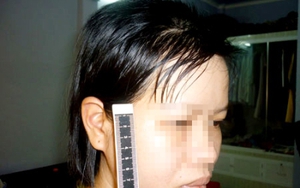 Bác sỹ lột quần áo, đánh đập vợ sẩy thai