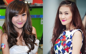 Hot girl Kelly: "Phẫu thuật cằm 5 lần và suýt phải cắt bỏ cằm vì hoại tử"
