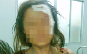 Phó ban Tuyên giáo huyện đánh một phụ nữ gẫy răng