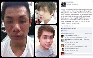 "Hot boy" hóa "dị nhân" bởi thảm họa tẩy trắng da