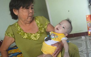 Thắt lòng vì bé gái 11 tháng tuổi mắc bệnh xương hóa đá