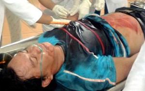 2 vợ chồng nhập viện trong tình trạng bê bết máu
