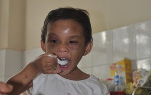 Bé gái 4 tuổi bị bạo hành liên tục kêu đói, thèm ăn cơm