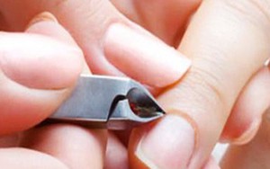 Cắt móng tay, móng chân hàng ngày: Hại nhiều hơn lợi