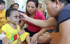 Cha mẹ đánh bé 4 tuổi chấn thương sọ não rồi nói chỉ là "dạy con"