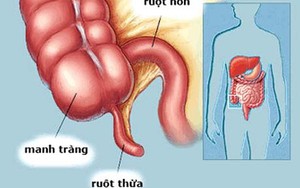 Sự thật về 7 bộ phận mang tiếng "thừa" trên cơ thể