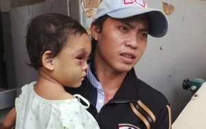 Vụ bé gái 4 tuổi bị hành hạ: "Hãy để bé Ngân về sống với bố ruột"