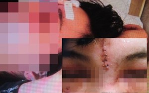 Phẫn nộ vì 2 cô gái bị sàm sỡ giữa Hà Nội