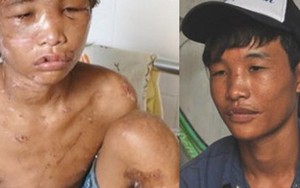 Luôn còn nghệ sĩ, độc giả thương cảm cho Hào Anh
