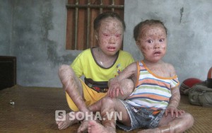 2 cháu bé mắc bệnh "kì dị": Nhiều lần bác sĩ không khám bệnh cho