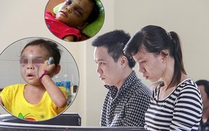 Cặp tình nhân đánh bé 3 tuổi chấn thương sọ não lĩnh án