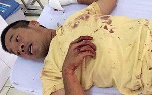 Người đàn ông bị chém ngay trước mặt cảnh sát