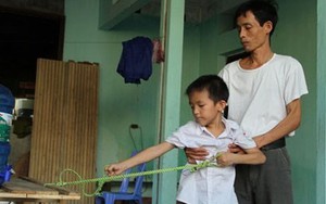 Cậu bé mắc bệnh lạ, hai tay cử động như một