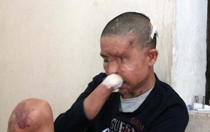 Vợ chồng phụ xe trong vụ nổ trên xe khách không dám về nhà