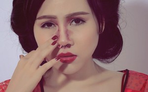 Hình ảnh thẩm mỹ đau đớn của diễn viên "lùn nhất showbiz Việt"