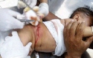 Phẫn nộ vụ xiết nợ bố, chém trọng thương con gái 14 tháng tuổi