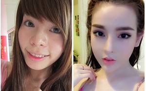 Ngỡ ngàng với ảnh TRƯỚC VÀ SAU phẫu thuật của hot girl Vân Tokyo