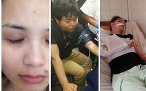 Hình ảnh sao Việt đau đớn vì bị bạo hành, tai nạn