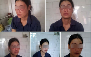 Căm phẫn cảnh chồng bắt vợ ăn phân, dùng then cửa đánh vào mặt...