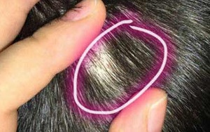 Kinh hoàng 5 cô giáo dùng kim đâm trẻ mầm non