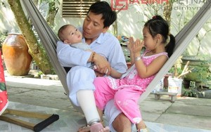 Bố em bé văng ra khỏi bụng mẹ tập tễnh đi bằng chân giả