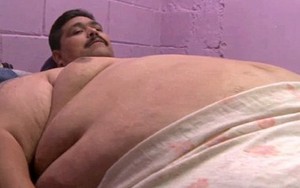 Người đàn ông béo nhất thế giới cắt 70% dạ dày để giảm cân