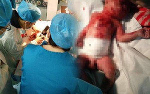 Sự tàn độc đến rợn người của "bà mẹ 15 tuổi"
