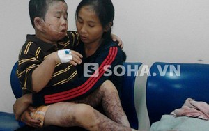 Cha mẹ bất lực nhìn con kêu khóc trong đau đớn, đôi chân teo dần
