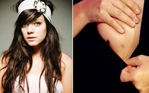 Bộ phận cơ thể dị tật của những người đẹp đình đám