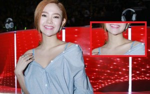 Chiếc cằm nhọn hoắt khó hiểu của Minh Hằng